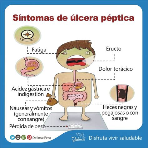 sintomas de úlcera